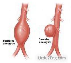 aneurysm Urdu Meaning