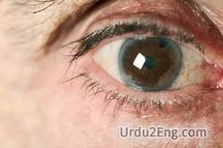 cataract Urdu Meaning