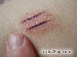 wound Urdu Meaning