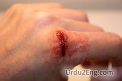 wound Urdu Meaning